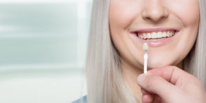 dental veneer