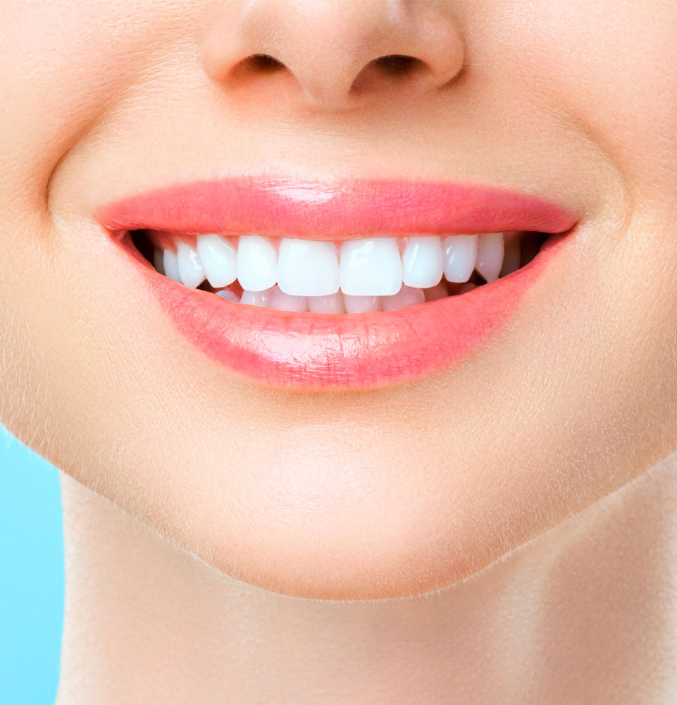 closeup of whitened smile
