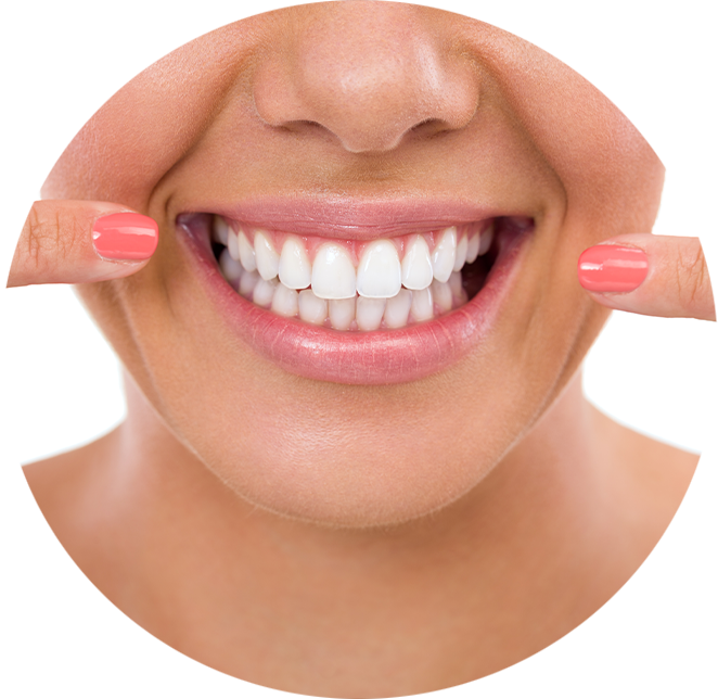 Very nice lady pointing to her beautiful smile